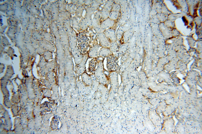 IGSF11 Antibody in Immunohistochemistry (Paraffin) (IHC (P))