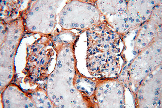 IGSF11 Antibody in Immunohistochemistry (Paraffin) (IHC (P))