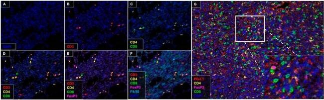 FOXP3 Antibody in Immunohistochemistry (Paraffin) (IHC (P))