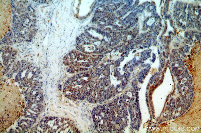 ESR2 Antibody in Immunohistochemistry (Paraffin) (IHC (P))