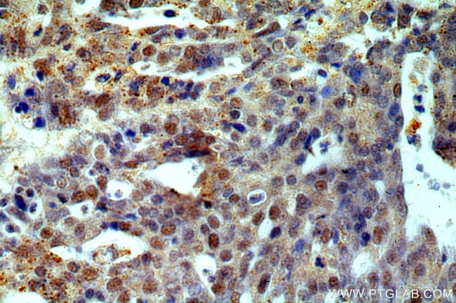 ESR2 Antibody in Immunohistochemistry (Paraffin) (IHC (P))