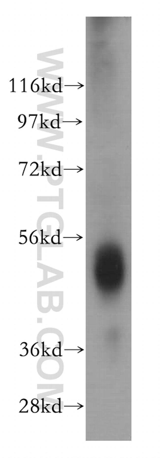 ESR2 Antibody in Western Blot (WB)