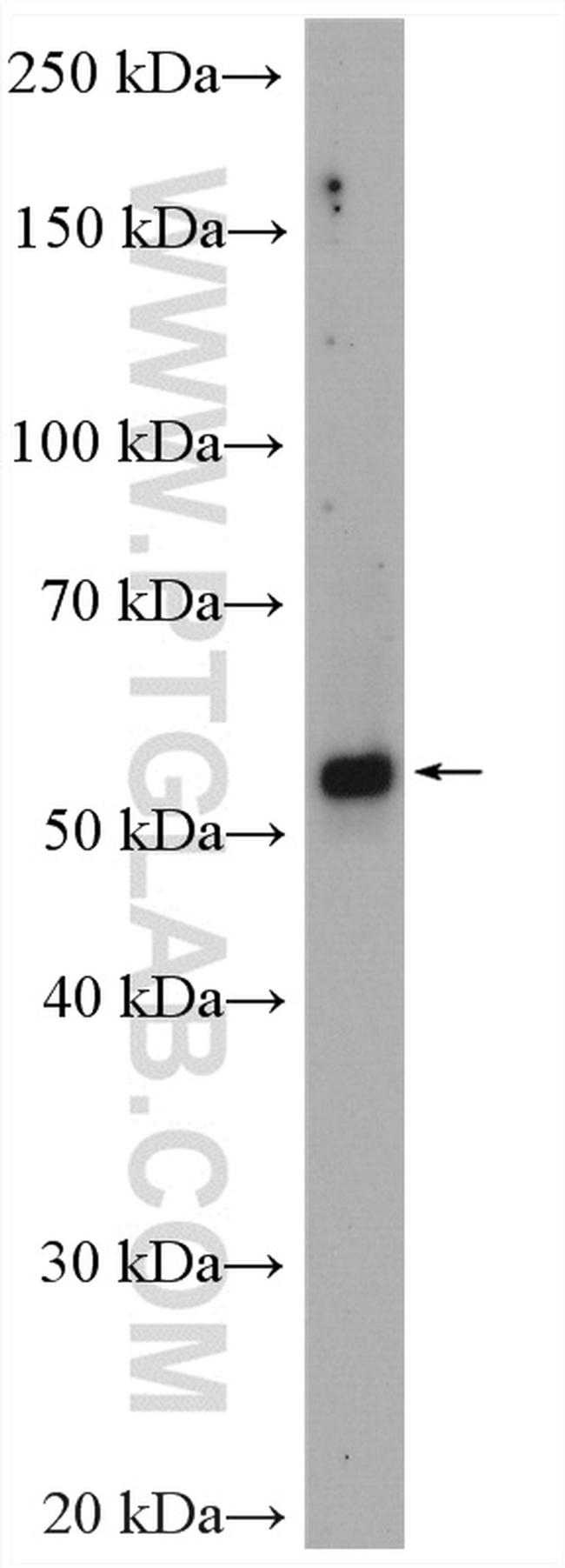 ESR2 Antibody in Western Blot (WB)