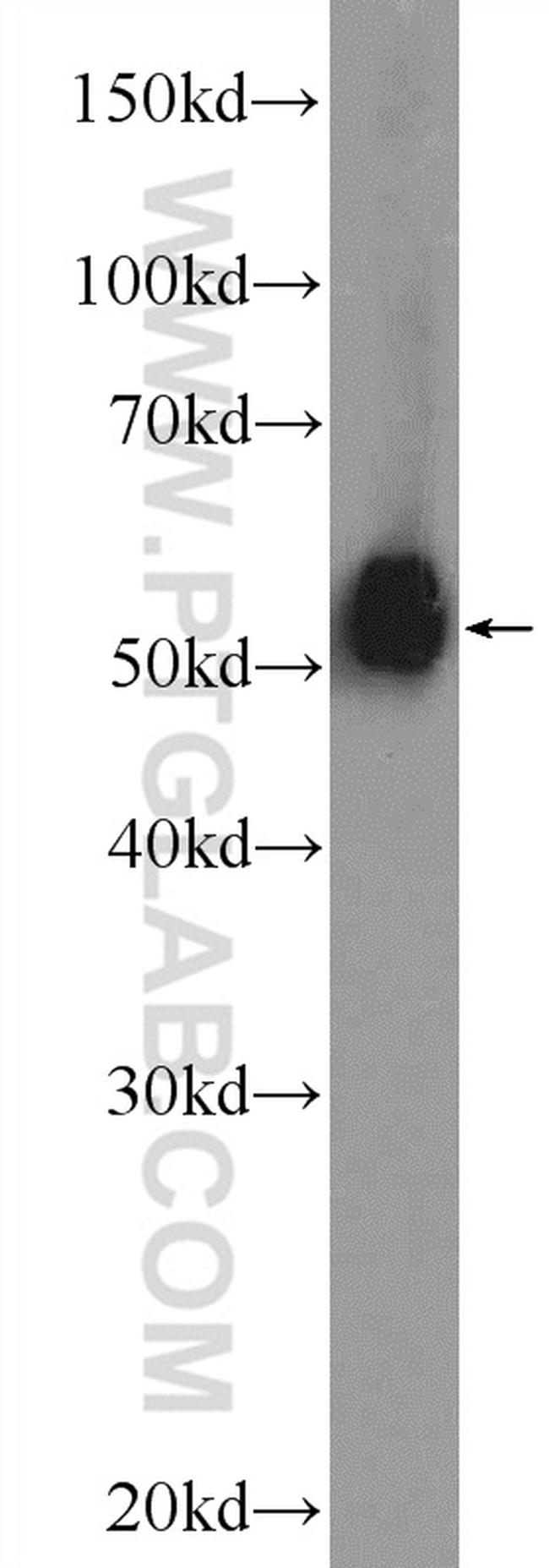 ESR2 Antibody in Western Blot (WB)