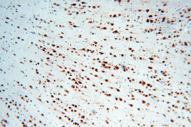 ELAVL2 Antibody in Immunohistochemistry (Paraffin) (IHC (P))