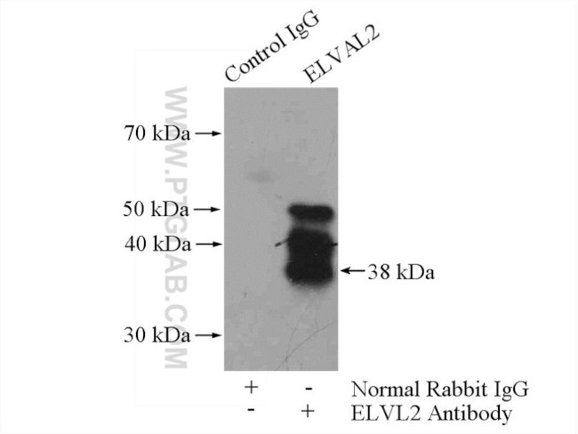 ELAVL2 Antibody in Immunoprecipitation (IP)