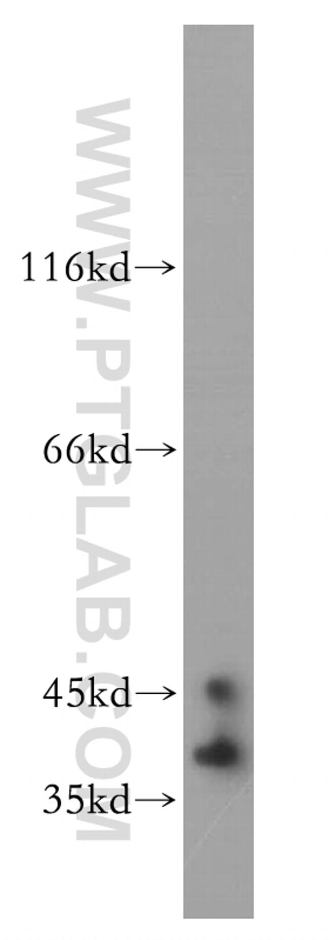 ELAVL2 Antibody in Western Blot (WB)