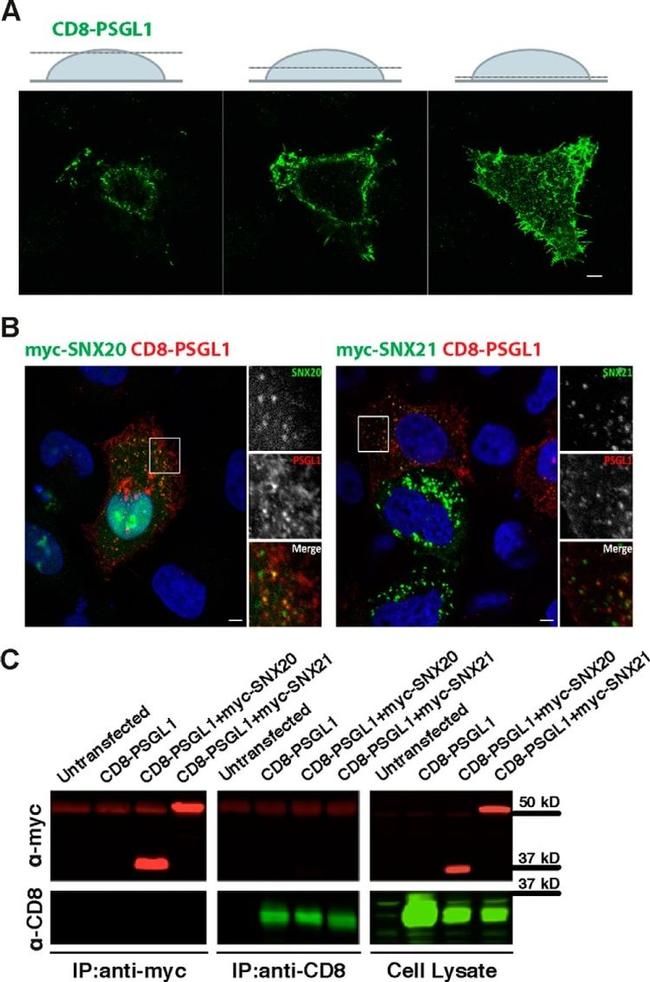 CD8a Antibody in Immunocytochemistry (ICC/IF)