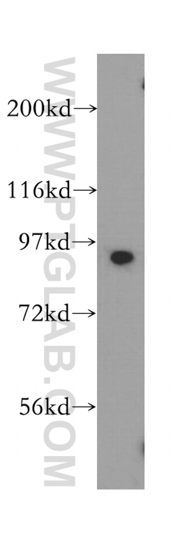 SOX6 Antibody in Western Blot (WB)