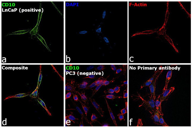 CD10 Antibody in Immunocytochemistry (ICC/IF)