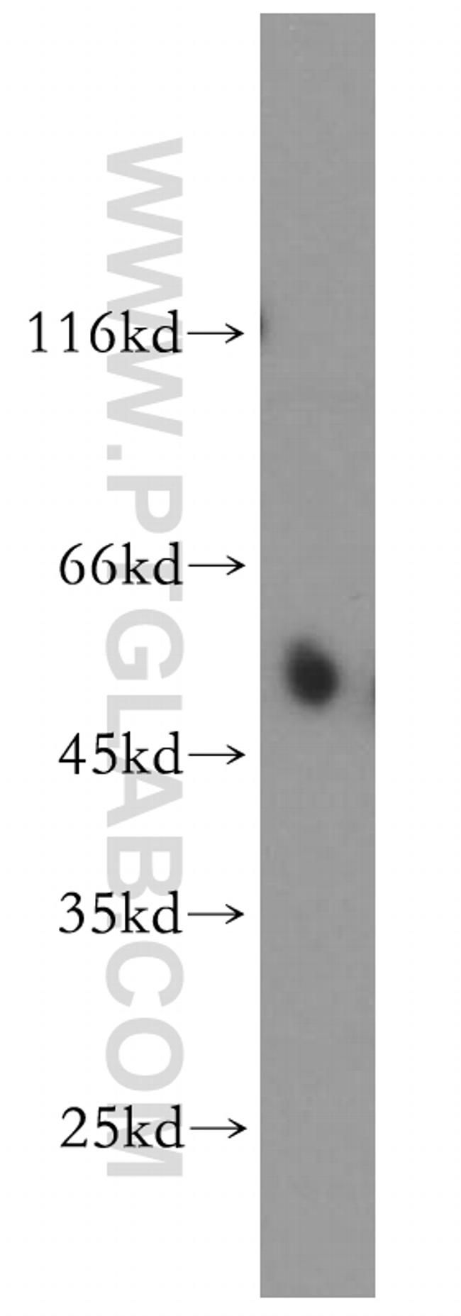 ESRRG Antibody in Western Blot (WB)