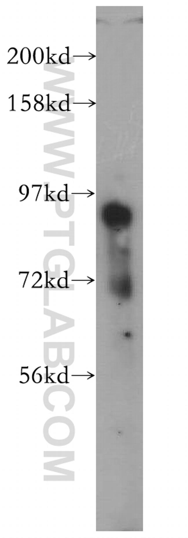 PCDHB12 Antibody in Western Blot (WB)