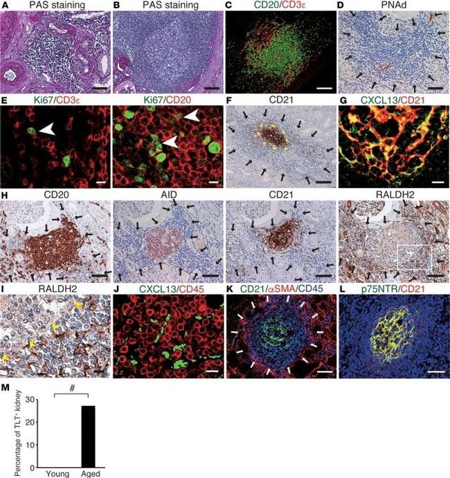 CD45 Antibody in Immunohistochemistry (IHC)