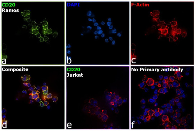 CD20 Antibody in Immunocytochemistry (ICC/IF)