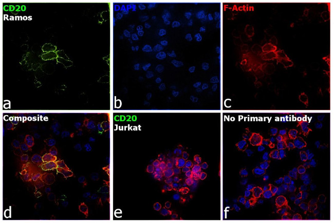 CD20 Antibody