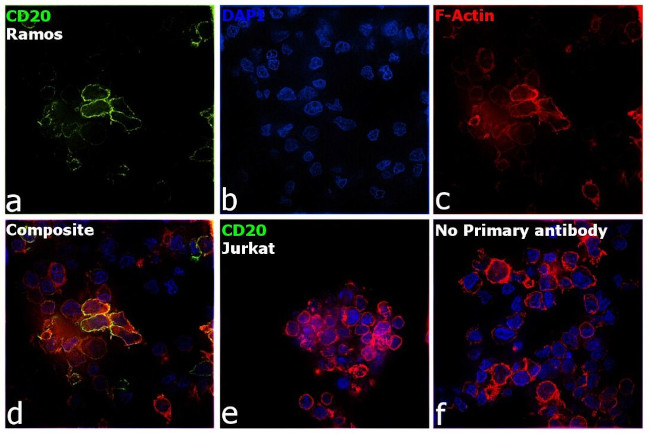 CD20 Antibody in Immunocytochemistry (ICC/IF)