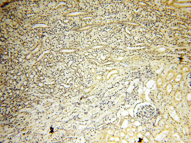 AADACL1 Antibody in Immunohistochemistry (Paraffin) (IHC (P))