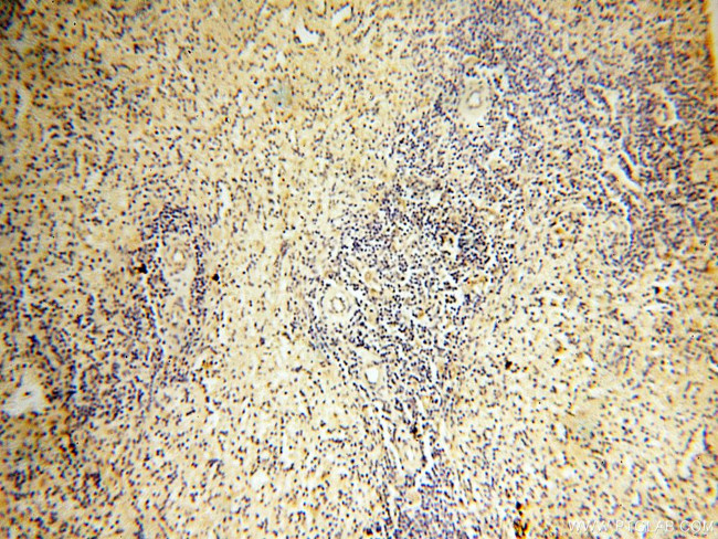 AADACL1 Antibody in Immunohistochemistry (Paraffin) (IHC (P))