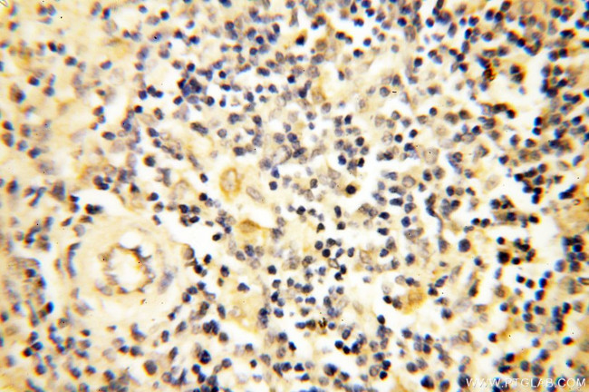 AADACL1 Antibody in Immunohistochemistry (Paraffin) (IHC (P))