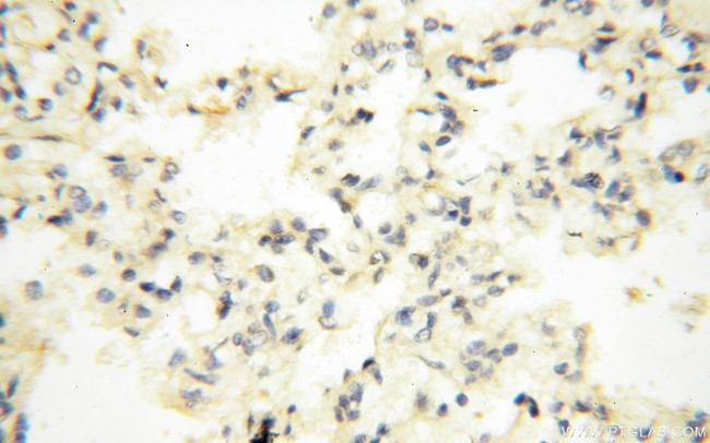 AADACL1 Antibody in Immunohistochemistry (Paraffin) (IHC (P))