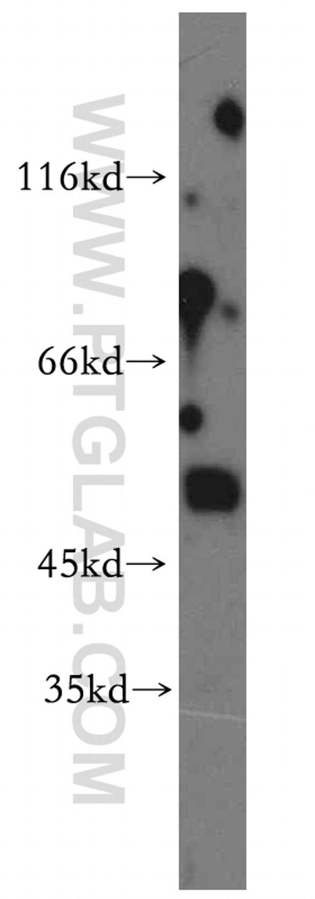 AADACL1 Antibody in Western Blot (WB)