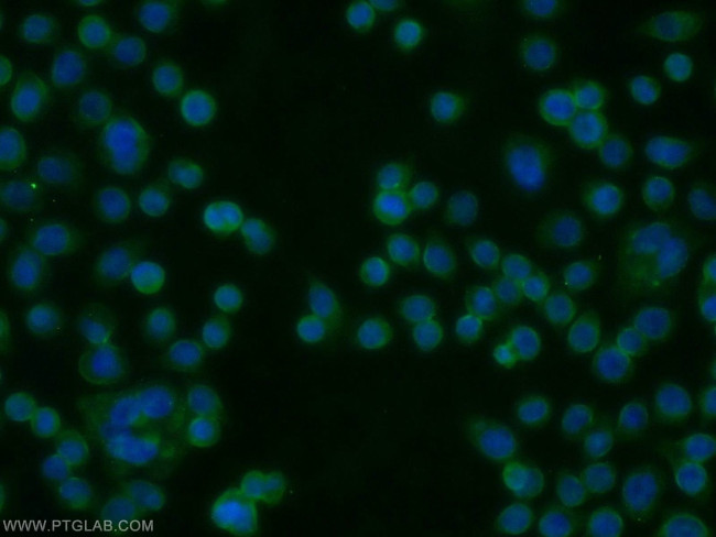 AADACL1 Antibody in Immunocytochemistry (ICC/IF)