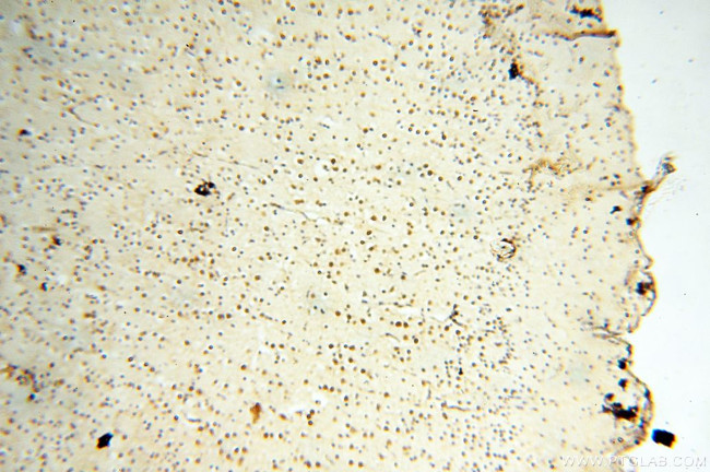 AADACL1 Antibody in Immunohistochemistry (Paraffin) (IHC (P))