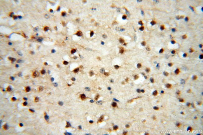 AADACL1 Antibody in Immunohistochemistry (Paraffin) (IHC (P))