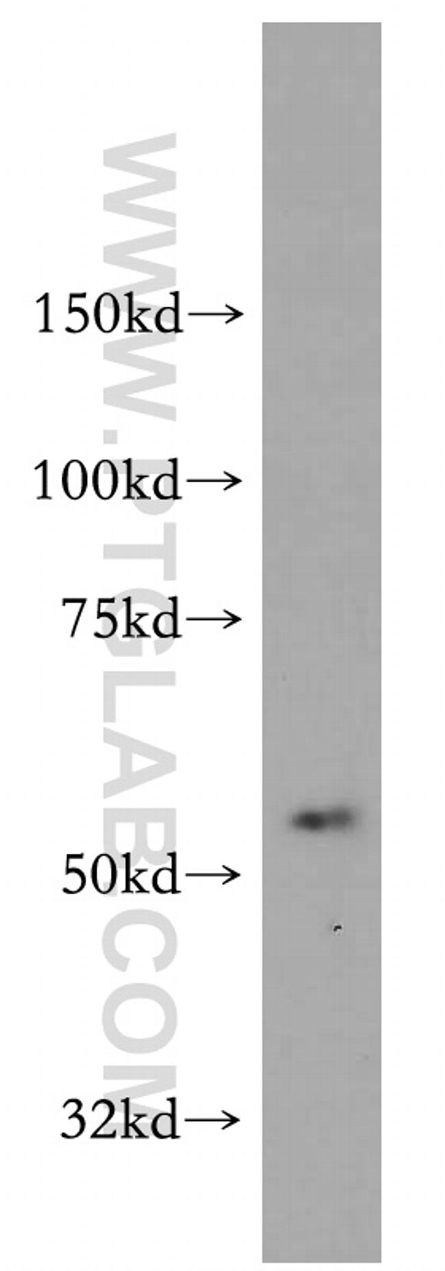 AADACL1 Antibody in Western Blot (WB)