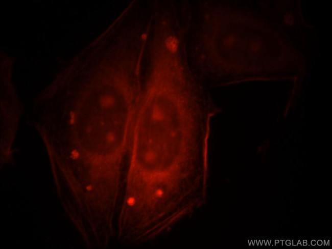 PSMA8 Antibody in Immunocytochemistry (ICC/IF)