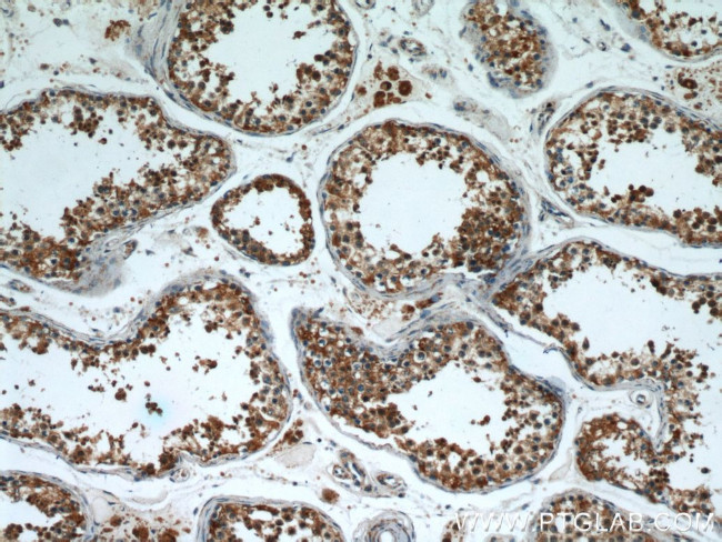 PSMA8 Antibody in Immunohistochemistry (Paraffin) (IHC (P))