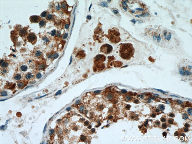 PSMA8 Antibody in Immunohistochemistry (Paraffin) (IHC (P))