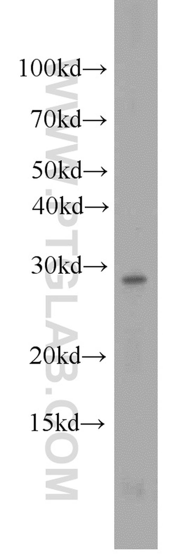 PSMA8 Antibody in Western Blot (WB)