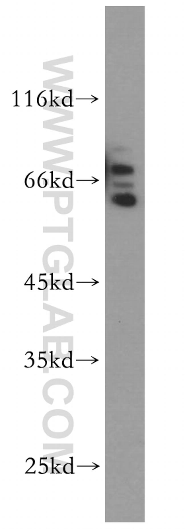 SYNCRIP Antibody in Western Blot (WB)