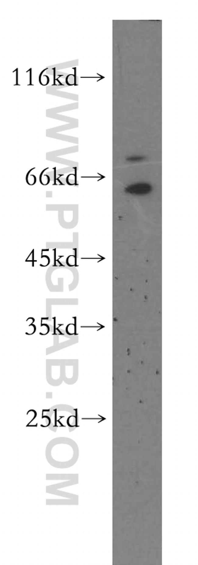 SYNCRIP Antibody in Western Blot (WB)