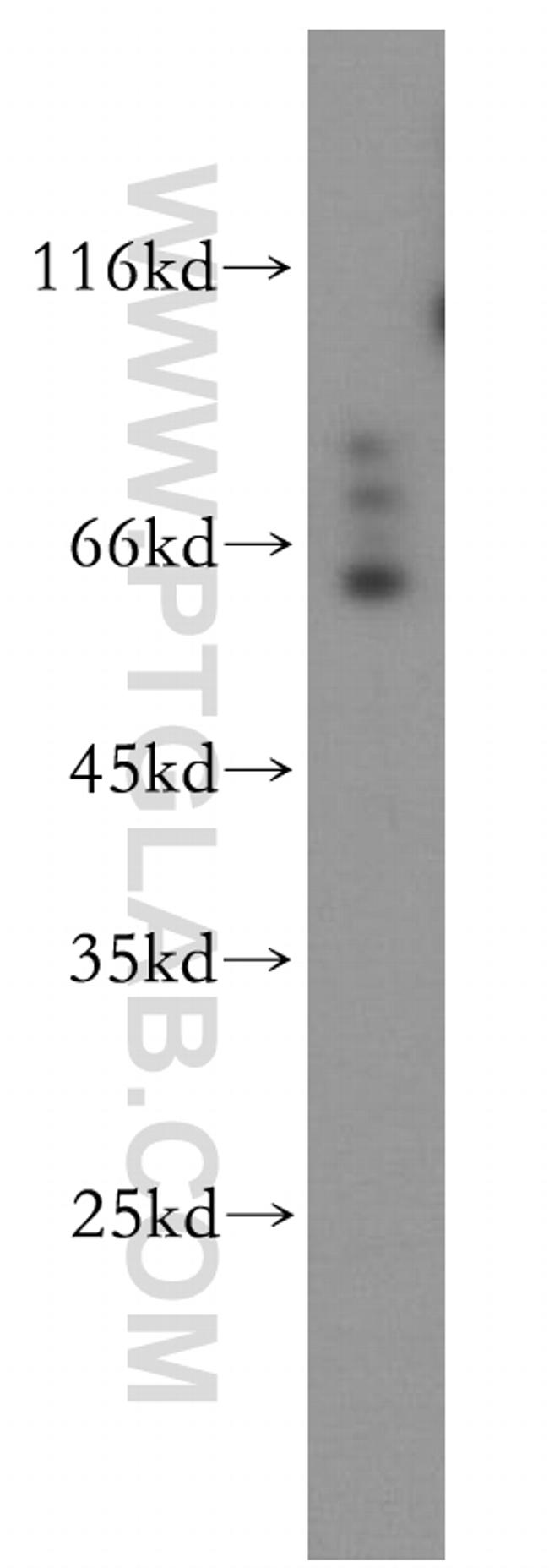 SYNCRIP Antibody in Western Blot (WB)