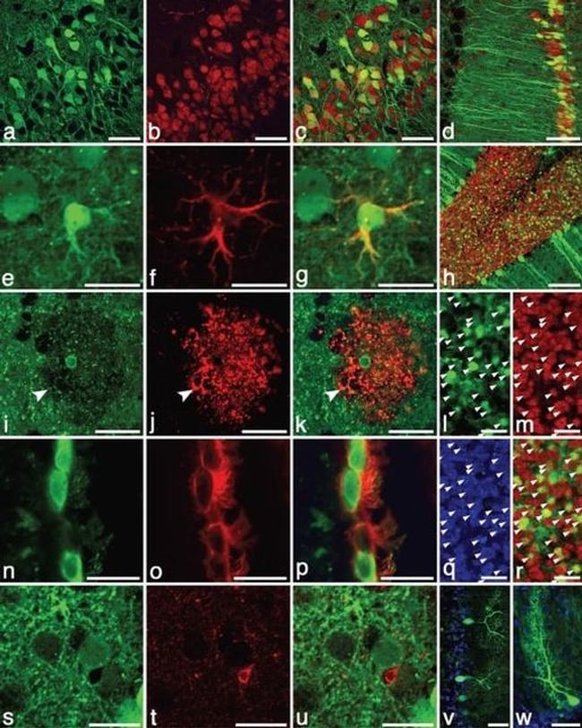 CD24 Antibody in Immunohistochemistry (IHC)