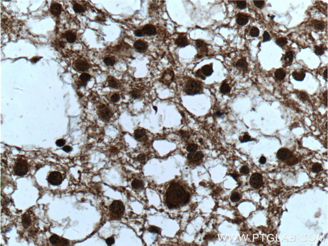 ZEB2 Antibody in Immunohistochemistry (Paraffin) (IHC (P))