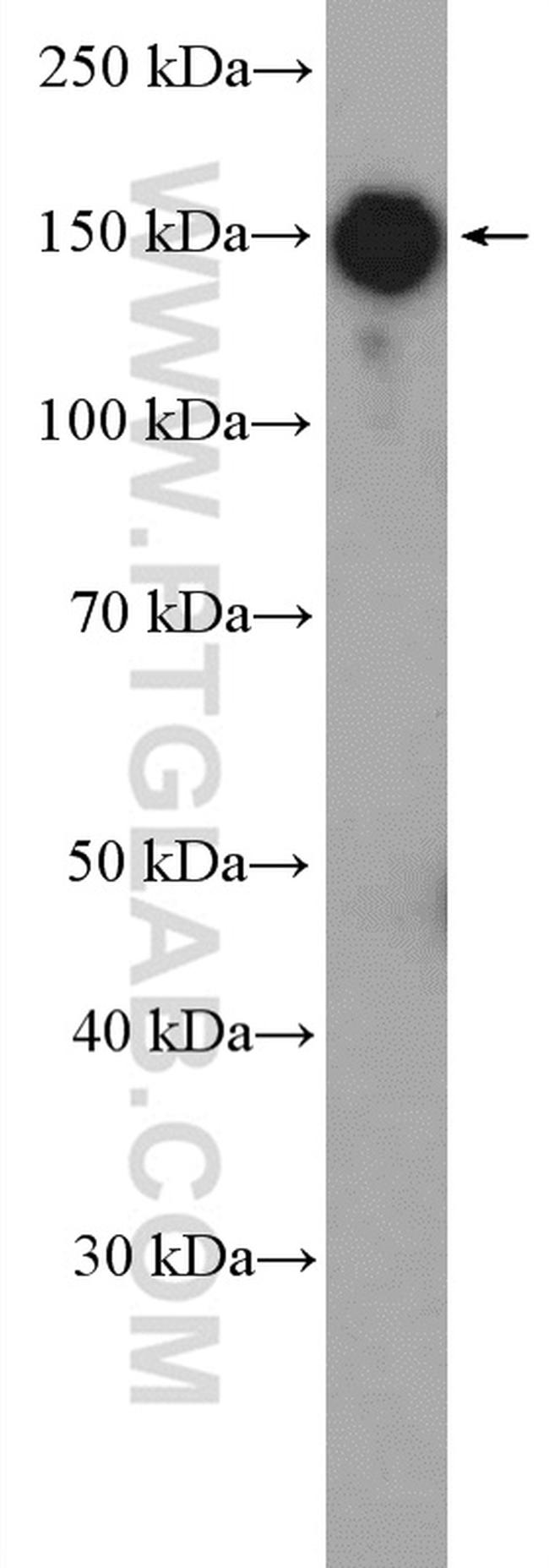 ZEB2 Antibody in Western Blot (WB)