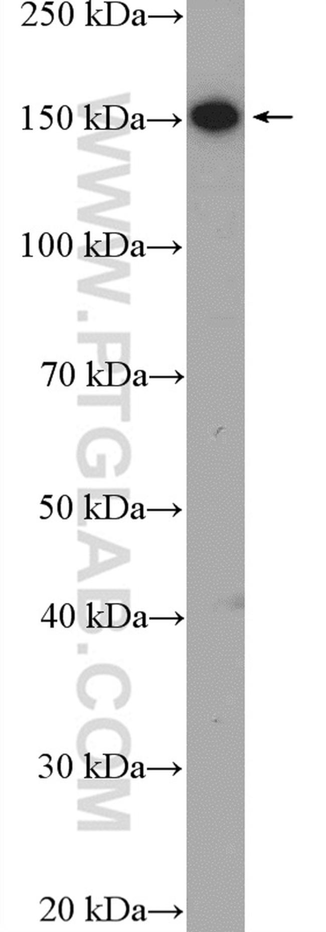 ZEB2 Antibody in Western Blot (WB)