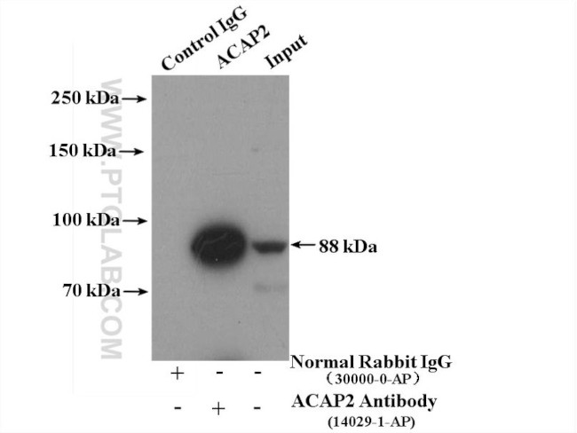 ACAP2 Antibody in Immunoprecipitation (IP)