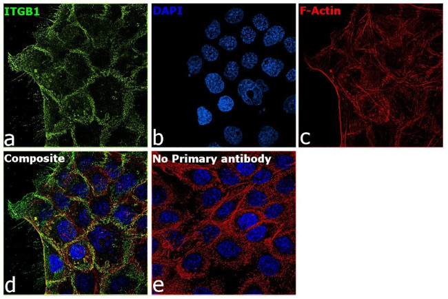 CD29 (Integrin beta 1) Antibody in Immunocytochemistry (ICC/IF)