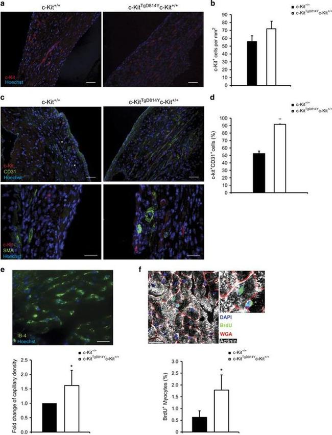 CD31 (PECAM-1) Antibody in Immunohistochemistry (IHC)