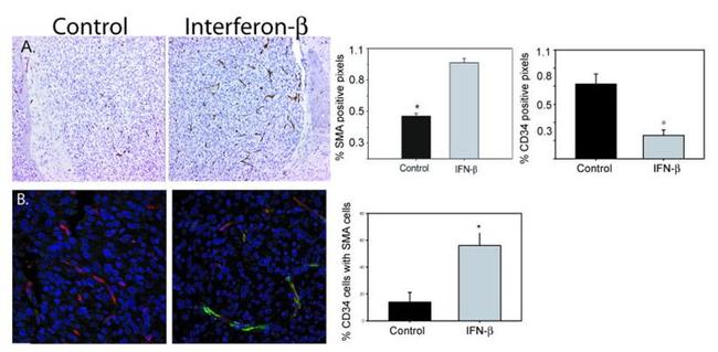 CD34 Antibody in Immunohistochemistry (Paraffin) (IHC (P))