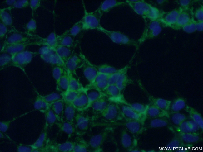 ABHD2 Antibody in Immunocytochemistry (ICC/IF)