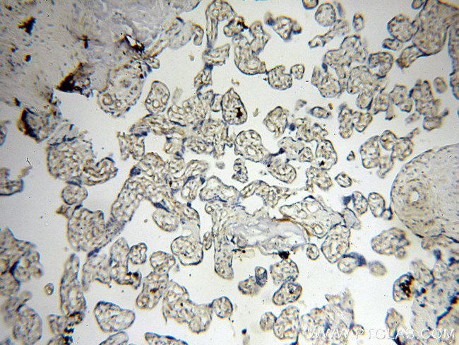 ABHD2 Antibody in Immunohistochemistry (Paraffin) (IHC (P))