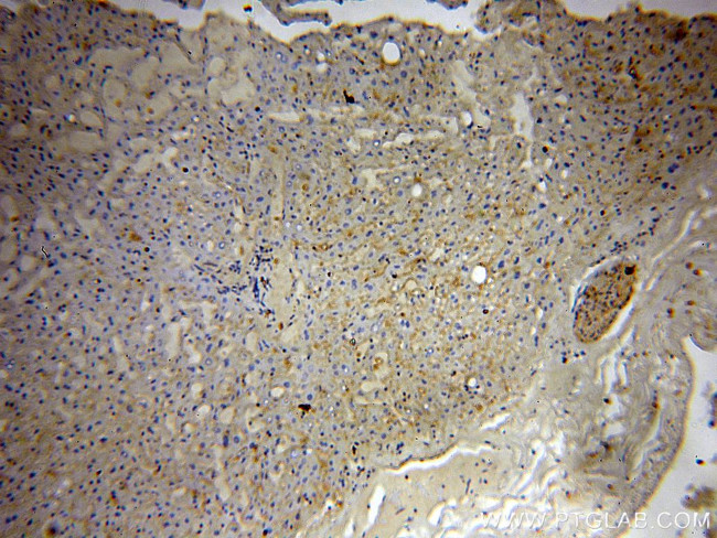 ABHD2 Antibody in Immunohistochemistry (Paraffin) (IHC (P))