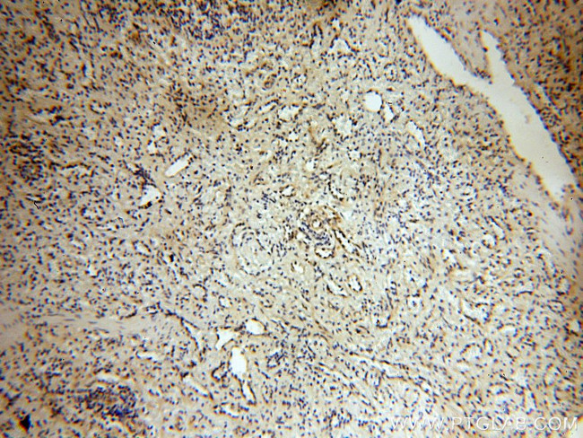 ABHD2 Antibody in Immunohistochemistry (Paraffin) (IHC (P))