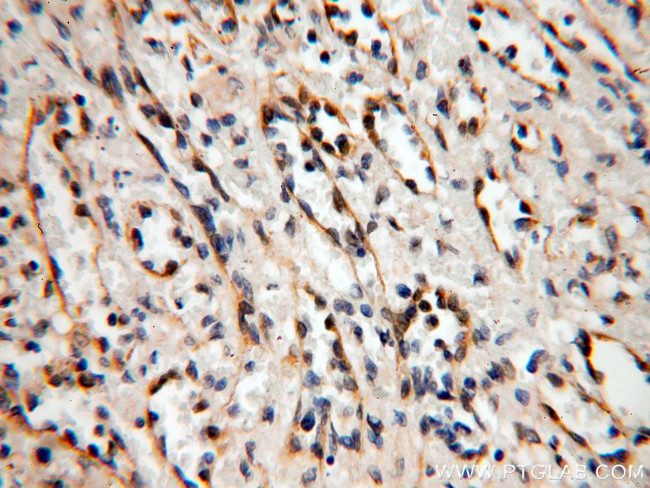 ABHD2 Antibody in Immunohistochemistry (Paraffin) (IHC (P))