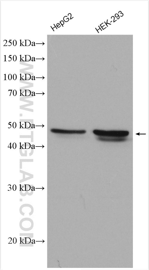 ABHD2 Antibody in Western Blot (WB)